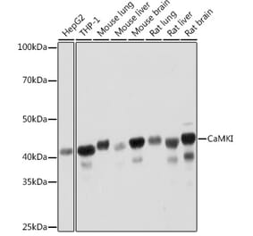 Western Blot - Anti-CaMKI Antibody [ARC2030] (A307498) - Antibodies.com