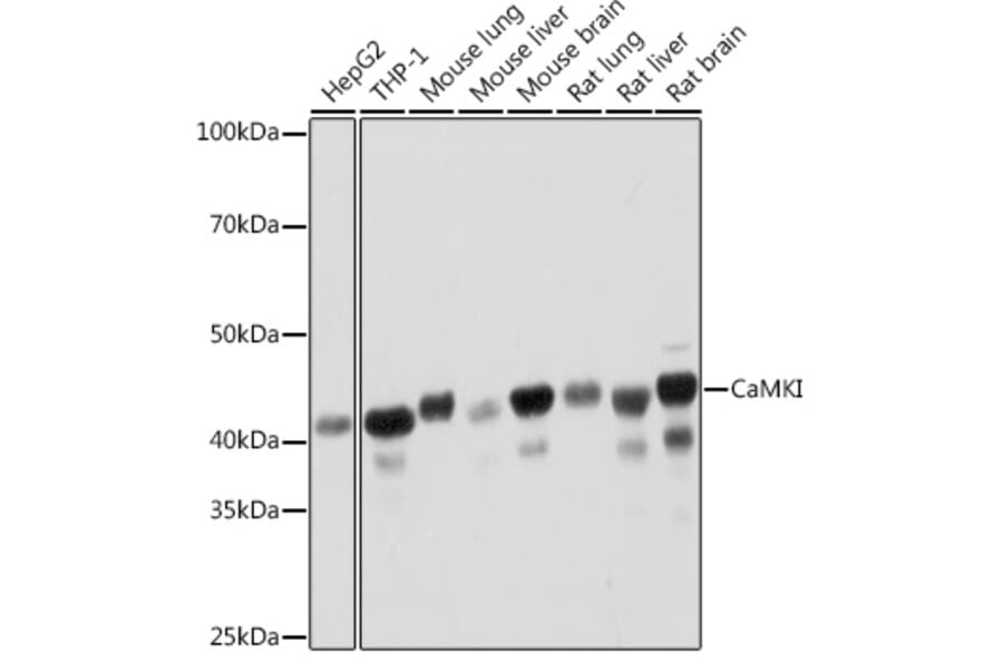 Western Blot - Anti-CaMKI Antibody [ARC2030] (A307498) - Antibodies.com