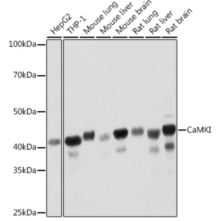 Western Blot - Anti-CaMKI Antibody [ARC2030] (A307498) - Antibodies.com