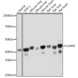 Western Blot - Anti-CaMKI Antibody [ARC2030] (A307498) - Antibodies.com
