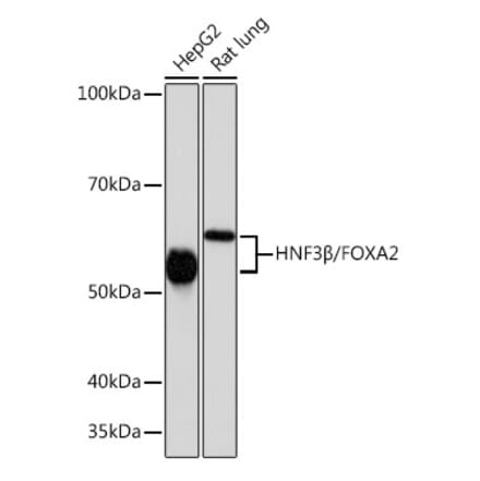 Western Blot - Anti-FOXA2 Antibody [ARC0391] (A307499) - Antibodies.com