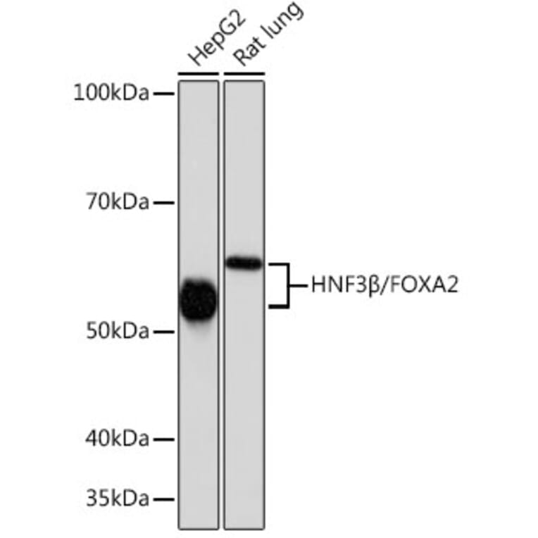 Western Blot - Anti-FOXA2 Antibody [ARC0391] (A307499) - Antibodies.com