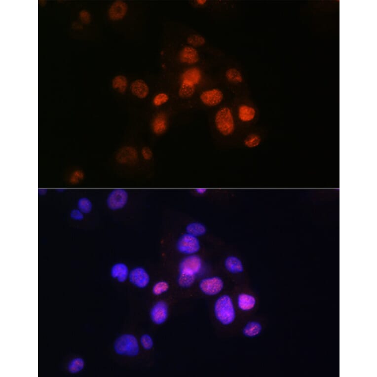 Immunofluorescence - Anti-FOXA2 Antibody [ARC0391] (A307499) - Antibodies.com