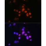 Immunofluorescence - Anti-FOXA2 Antibody [ARC0391] (A307499) - Antibodies.com