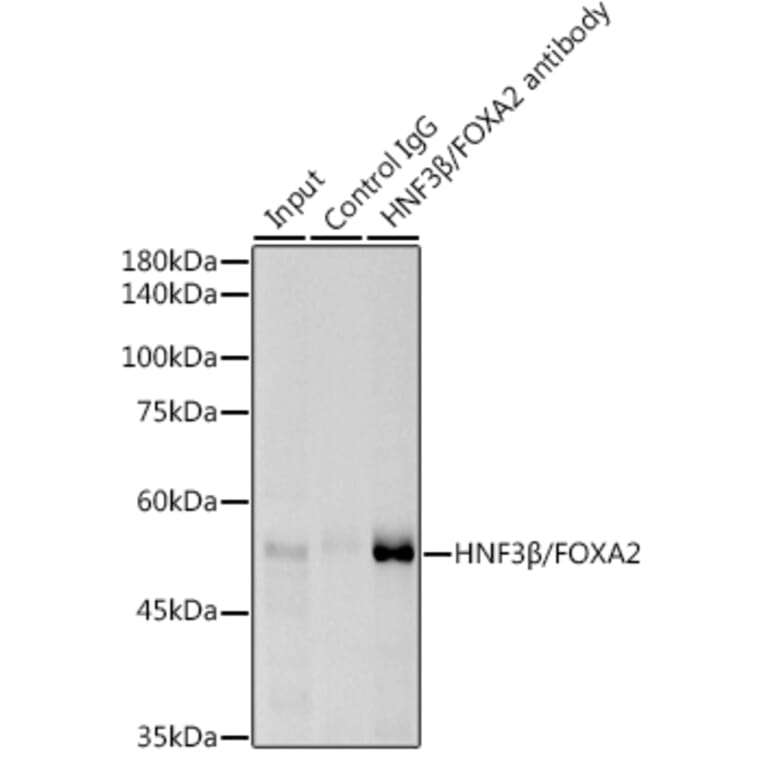 Western Blot - Anti-FOXA2 Antibody [ARC0391] (A307499) - Antibodies.com