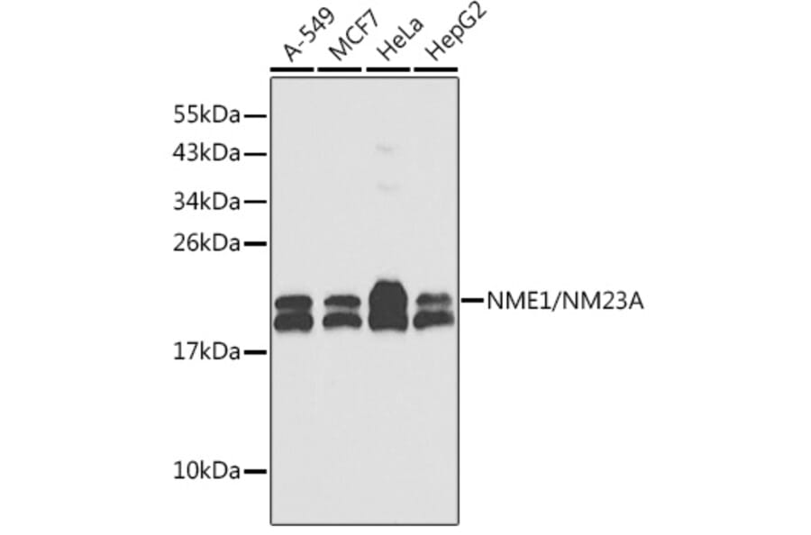 Western Blot - Anti-NM23A Antibody (A307500) - Antibodies.com