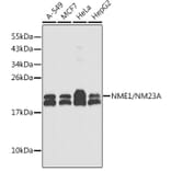 Western Blot - Anti-NM23A Antibody (A307500) - Antibodies.com