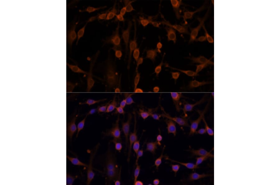 Immunofluorescence - Anti-NM23A Antibody (A307500) - Antibodies.com