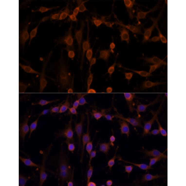 Immunofluorescence - Anti-NM23A Antibody (A307500) - Antibodies.com