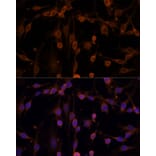 Immunofluorescence - Anti-NM23A Antibody (A307500) - Antibodies.com