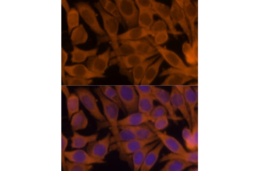 Immunofluorescence - Anti-NM23A Antibody (A307500) - Antibodies.com