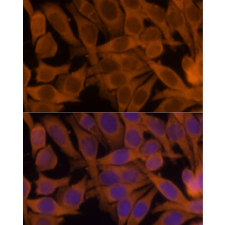 Immunofluorescence - Anti-NM23A Antibody (A307500) - Antibodies.com