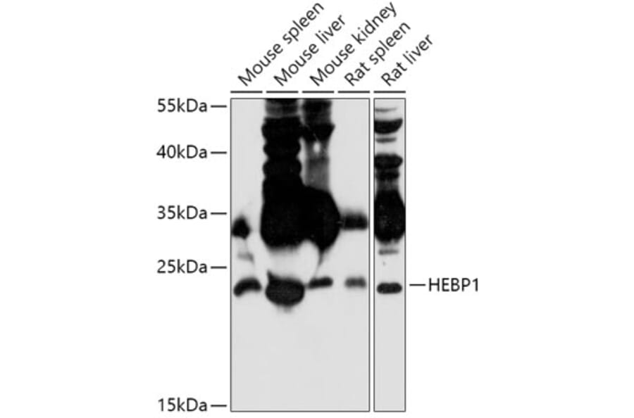 Western Blot - Anti-HBP Antibody (A307501) - Antibodies.com