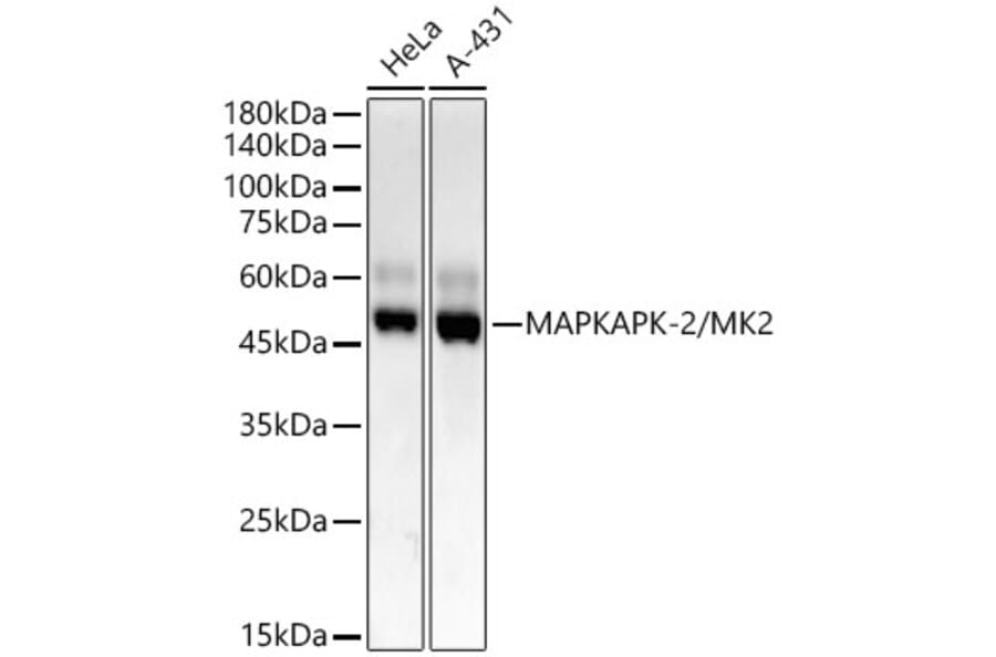 Western Blot - Anti-MK2 Antibody [ARC55427] (A307504) - Antibodies.com