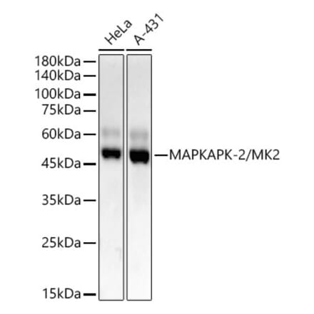 Western Blot - Anti-MK2 Antibody [ARC55427] (A307504) - Antibodies.com