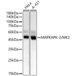 Western Blot - Anti-MK2 Antibody [ARC55427] (A307504) - Antibodies.com