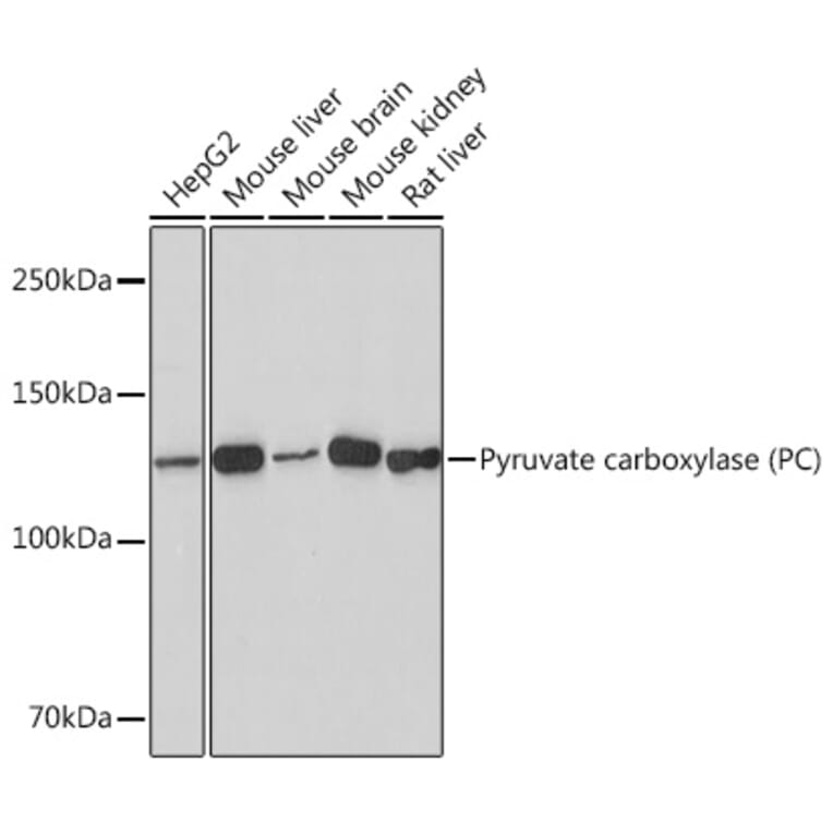 Western Blot - Anti-PCB Antibody [ARC1371] (A307505) - Antibodies.com