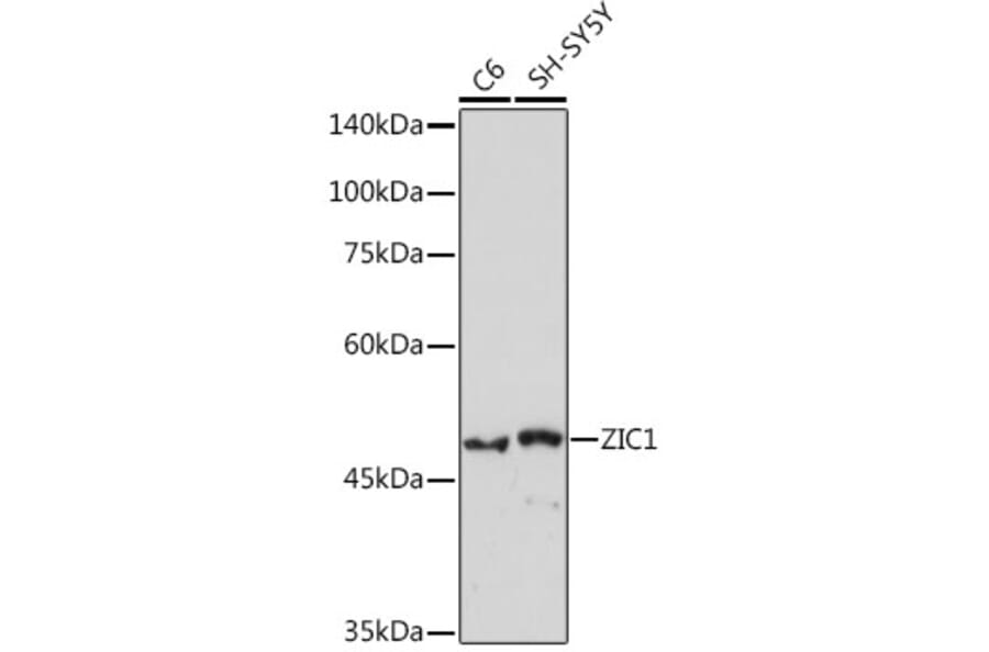 Western Blot - Anti-Zic1 Antibody [ARC2173] (A307506) - Antibodies.com