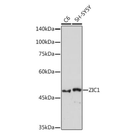 Western Blot - Anti-Zic1 Antibody [ARC2173] (A307506) - Antibodies.com