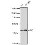 Western Blot - Anti-Zic1 Antibody [ARC2173] (A307506) - Antibodies.com
