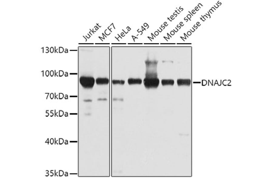 Western Blot - Anti-DNAJC2 / ZRF1 Antibody (A307508) - Antibodies.com