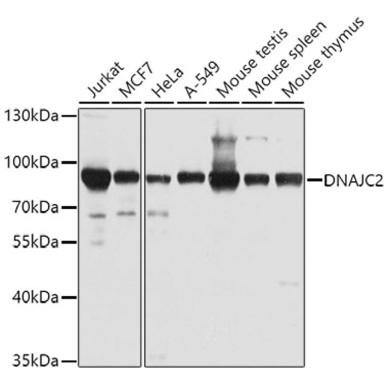 Western Blot - Anti-DNAJC2 / ZRF1 Antibody (A307508) - Antibodies.com