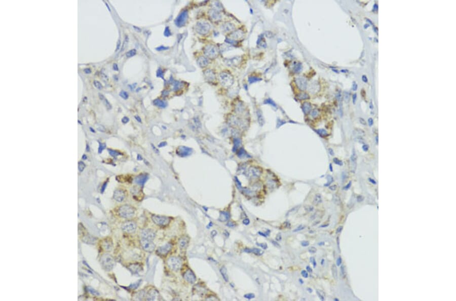 Immunohistochemistry - Anti-BMPR1B Antibody (A307509) - Antibodies.com