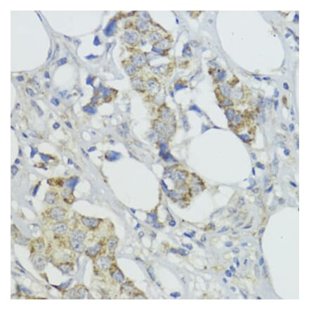 Immunohistochemistry - Anti-BMPR1B Antibody (A307509) - Antibodies.com