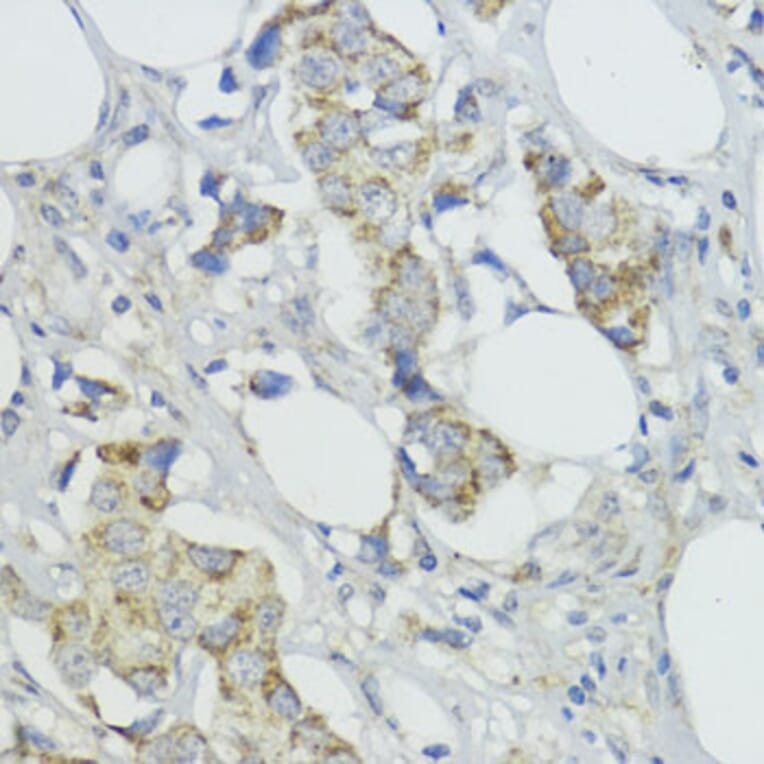 Immunohistochemistry - Anti-BMPR1B Antibody (A307509) - Antibodies.com