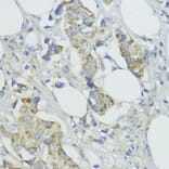 Immunohistochemistry - Anti-BMPR1B Antibody (A307509) - Antibodies.com