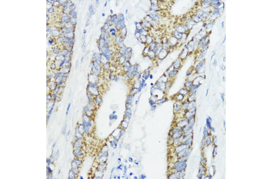 Immunohistochemistry - Anti-BMPR1B Antibody (A307509) - Antibodies.com