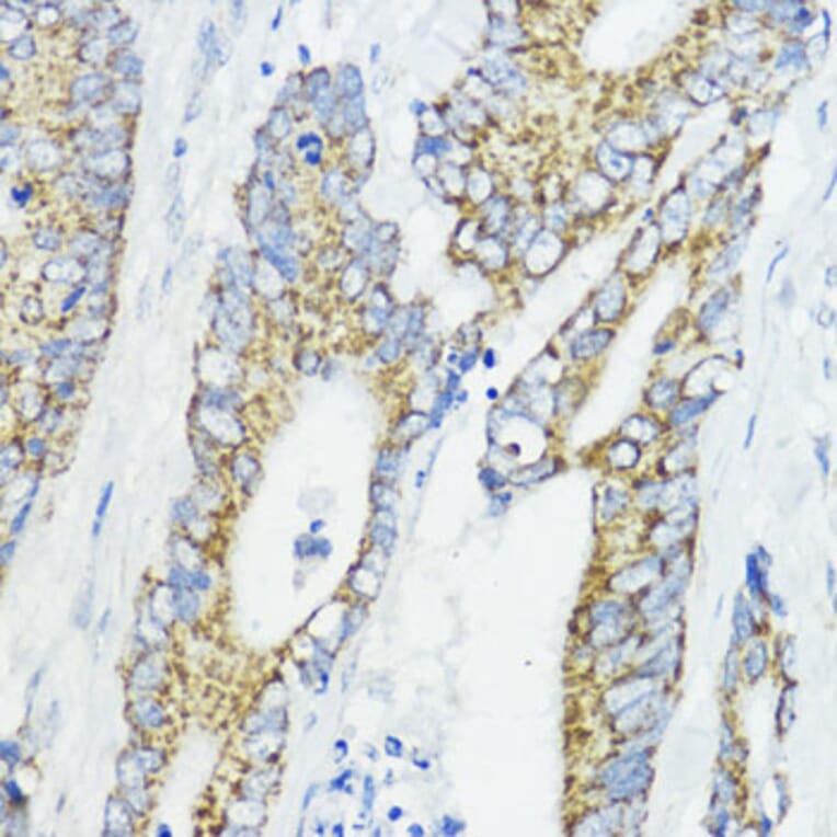 Immunohistochemistry - Anti-BMPR1B Antibody (A307509) - Antibodies.com