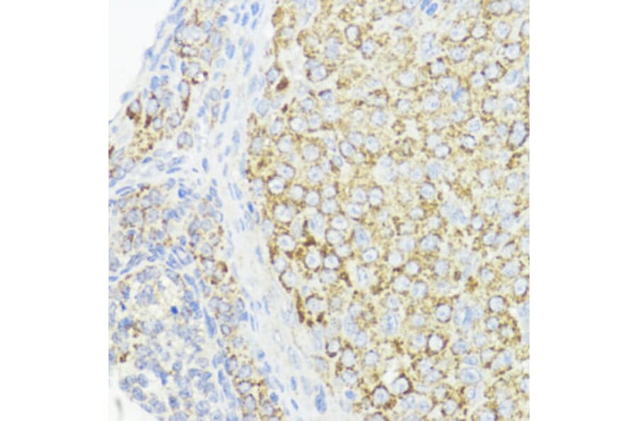 Immunohistochemistry - Anti-BMPR1B Antibody (A307509) - Antibodies.com
