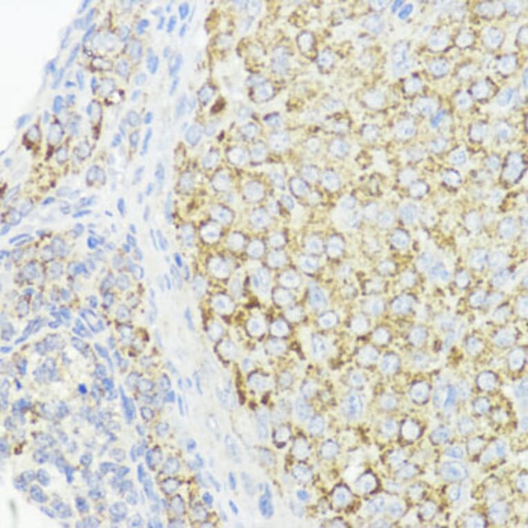 Immunohistochemistry - Anti-BMPR1B Antibody (A307509) - Antibodies.com