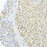 Immunohistochemistry - Anti-BMPR1B Antibody (A307509) - Antibodies.com
