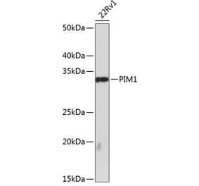 Western Blot - Anti-PIM1 Antibody [ARC0175] (A307510) - Antibodies.com