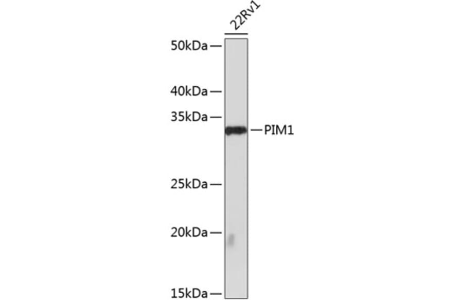 Western Blot - Anti-PIM1 Antibody [ARC0175] (A307510) - Antibodies.com