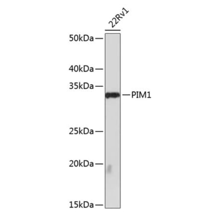 Western Blot - Anti-PIM1 Antibody [ARC0175] (A307510) - Antibodies.com
