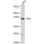 Western Blot - Anti-PIM1 Antibody [ARC0175] (A307510) - Antibodies.com