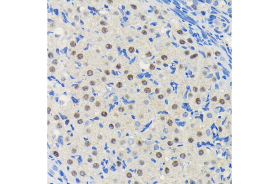 Immunohistochemistry - Anti-PIM1 Antibody [ARC0175] (A307510) - Antibodies.com