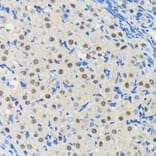 Immunohistochemistry - Anti-PIM1 Antibody [ARC0175] (A307510) - Antibodies.com