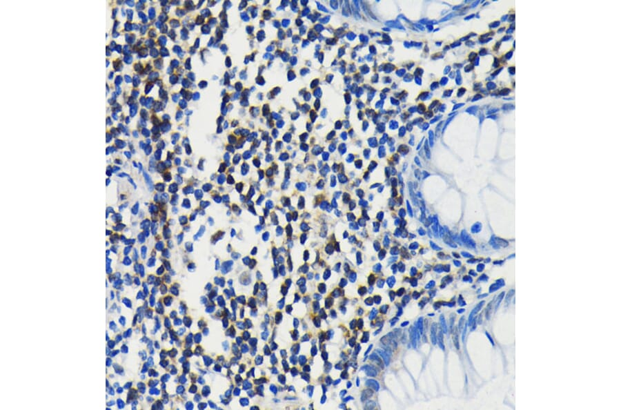 Immunohistochemistry - Anti-PIM1 Antibody [ARC0175] (A307510) - Antibodies.com