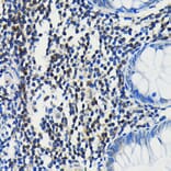 Immunohistochemistry - Anti-PIM1 Antibody [ARC0175] (A307510) - Antibodies.com