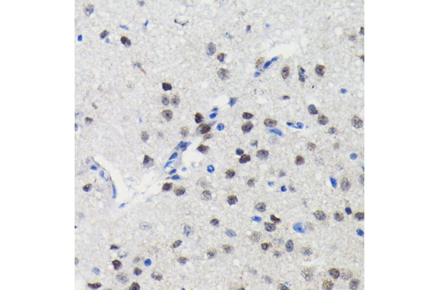 Immunohistochemistry - Anti-PIM1 Antibody [ARC0175] (A307510) - Antibodies.com