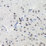 Immunohistochemistry - Anti-PIM1 Antibody [ARC0175] (A307510) - Antibodies.com