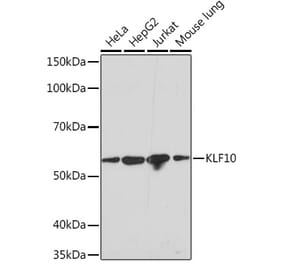 Western Blot - Anti-KLF10 Antibody [ARC1921] (A307511) - Antibodies.com