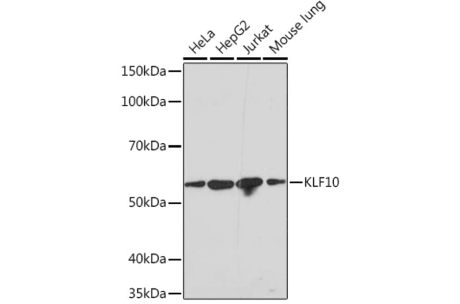 Western Blot - Anti-KLF10 Antibody [ARC1921] (A307511) - Antibodies.com
