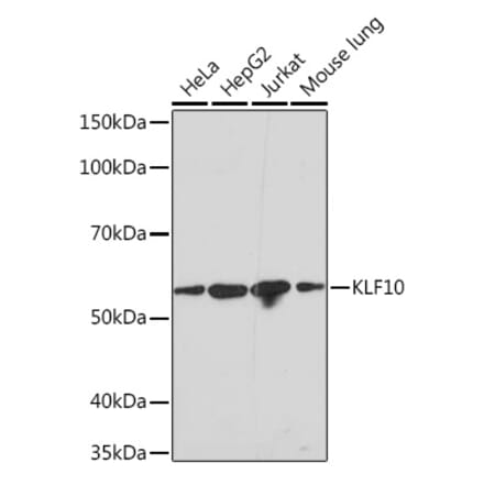 Western Blot - Anti-KLF10 Antibody [ARC1921] (A307511) - Antibodies.com