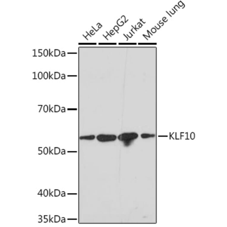 Western Blot - Anti-KLF10 Antibody [ARC1921] (A307511) - Antibodies.com