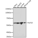 Western Blot - Anti-KLF10 Antibody [ARC1921] (A307511) - Antibodies.com